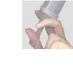 SCHIZZETTONE PLASTICA 100ML - Farmacianuova.eu